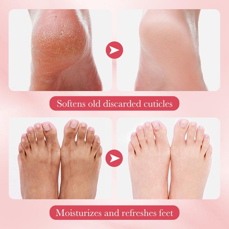 زوج واحد من أقنعة القدم من ساد - مراجعة Skincare Exfoliating وسعره